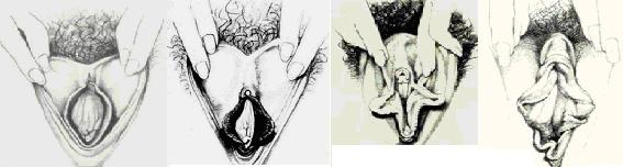 labia These are just a few examples of different ways that labia can look. These are drawings that were done by a woman named Betty Dodson, modeled after real women.
